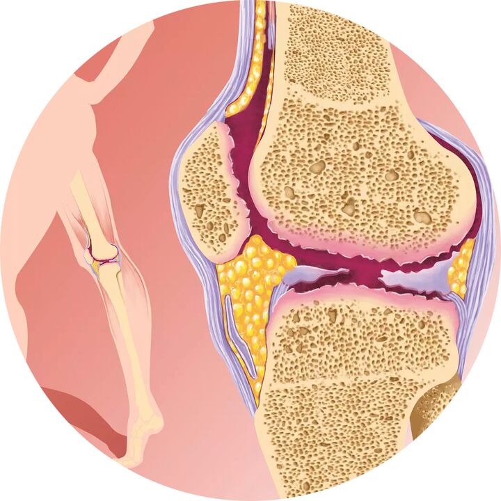 Hondroten - Υποστηρίζει την κινητικότητα των αρθρώσεων